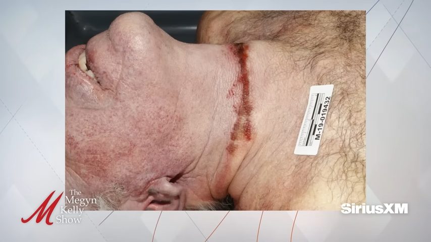 REVEALED_ Never-Before-Seen Autopsy Photo of Jeffrey Epstein’s Neck, with Epstein’s brother Mark 7-4 screenshot